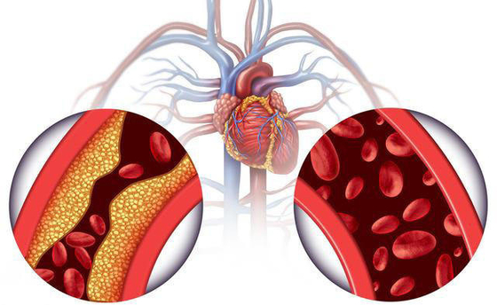 OEM تسمية خاصة dihydromyricetin من شاي الكرمة مستخلص شاي الكرمة مسحوق ديهيدروميريستين 98٪